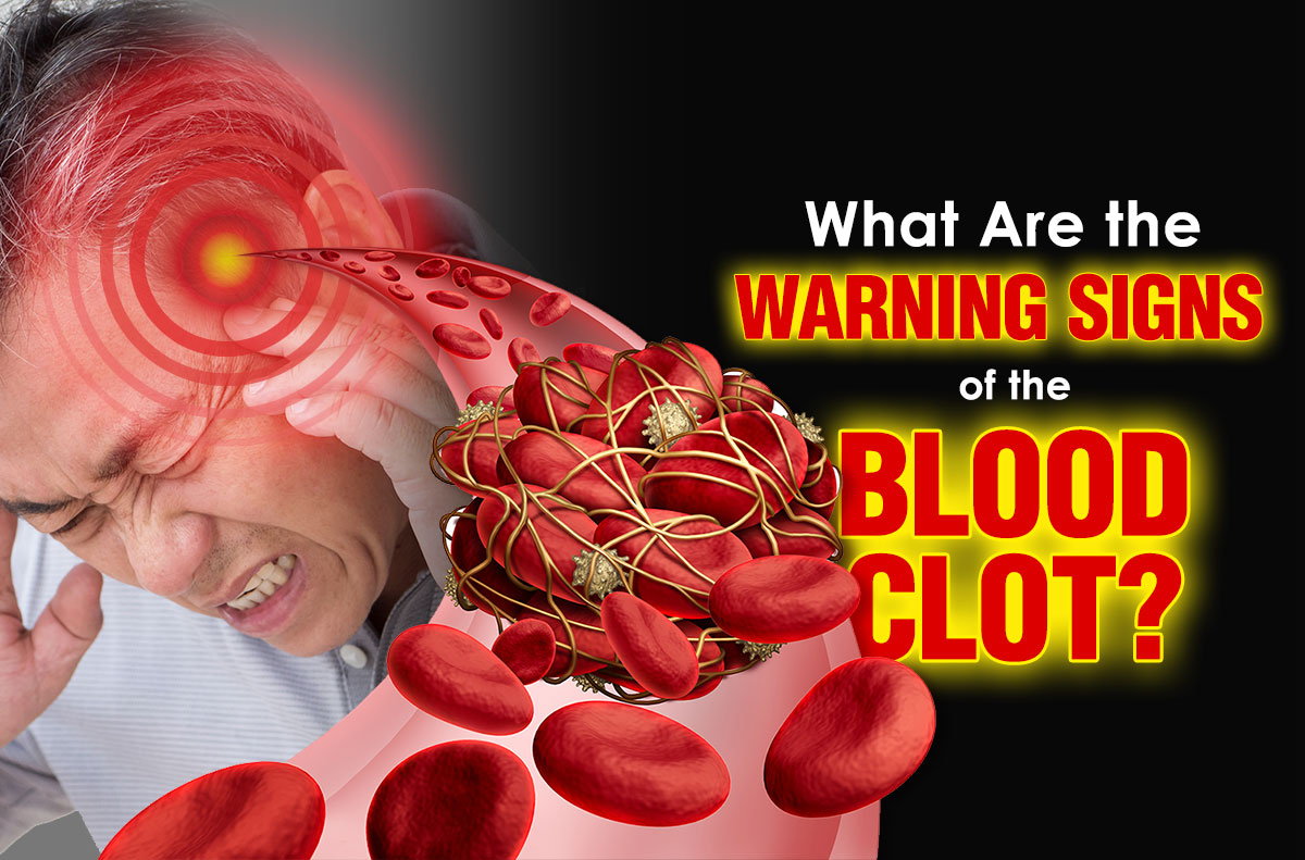 What Are the Warning Signs of a Blood Clot?